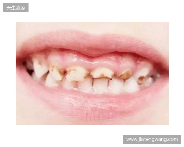 韦林顿确诊上唇部贯通伤；11、21牙半脱位；上颌前牙区牙槽骨骨折